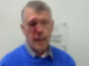 BRUTAL ATAQUE A PROVIDAS QUE REZABAN A LAS AFUERAS DE UN ABORTORIO EN EE. UU