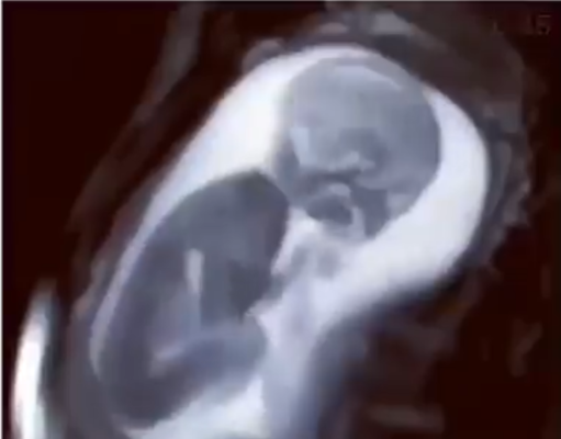 ¿SABÍAS QUE LAS EMOCIONES NEGATIVAS Y POSITIVAS DE UNA MADRE GESTANTE INFLUYEN EN EL BEBÉ?