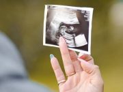 GRACIAS A LAS LEYES PROVIDA EN TEXAS (EE.UU) LA TASA DE NATALIDAD ES MÁS ALTA DE LO ESPERADO