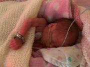 LA MEDICINA MODERNA AVANZA EN FAVOR DE SALVAR MÁS VIDAS DE BEBÉS EN EL VIENTRE MATERNO Y DE PROTEGER A LOS QUE NACEN PREMATUROS