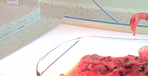 MACABRO: LA ABORTISTA PLANNED PARENTHOOD REALIZÓ UN INTERCAMBIO DE PARTES DE BEBES ABORTADOS CON FINES DE INVESTIGACIÓN CIENTÍFICA