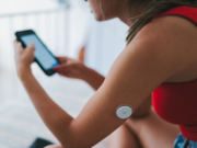 UNA ESPERANZA PARA EL TRATAMIENTO DE LA DIABETE TIPO 1: PACIENTE ES CURADA GRACIAS A UN TRASPLANTE DE CÉLULAS MADRE EXTRAÍDAS DE SU PROPIO CUERPO