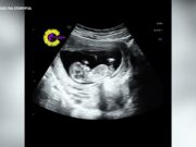 LO QUE PASA CUANDO A UNA MAMÁ EMBARAZADA LE DA ATAQUE DE RISA