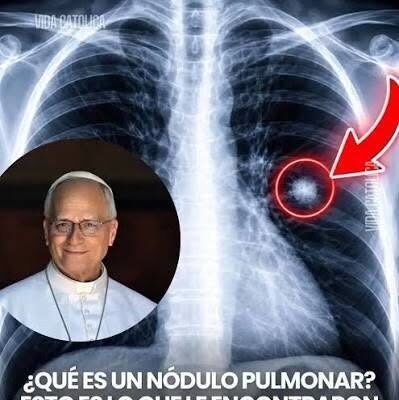 BUENA RECUPERACIÓN DEL PAPA LEÓN Y SU OPTIMISMO Y DESEOS SON MOTIVADOS POR SU GIRA A SUDAMÉRICA